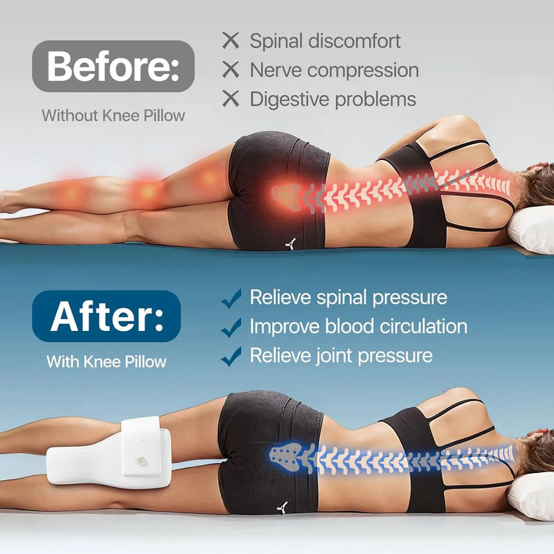 The Sciatica Pain Solution